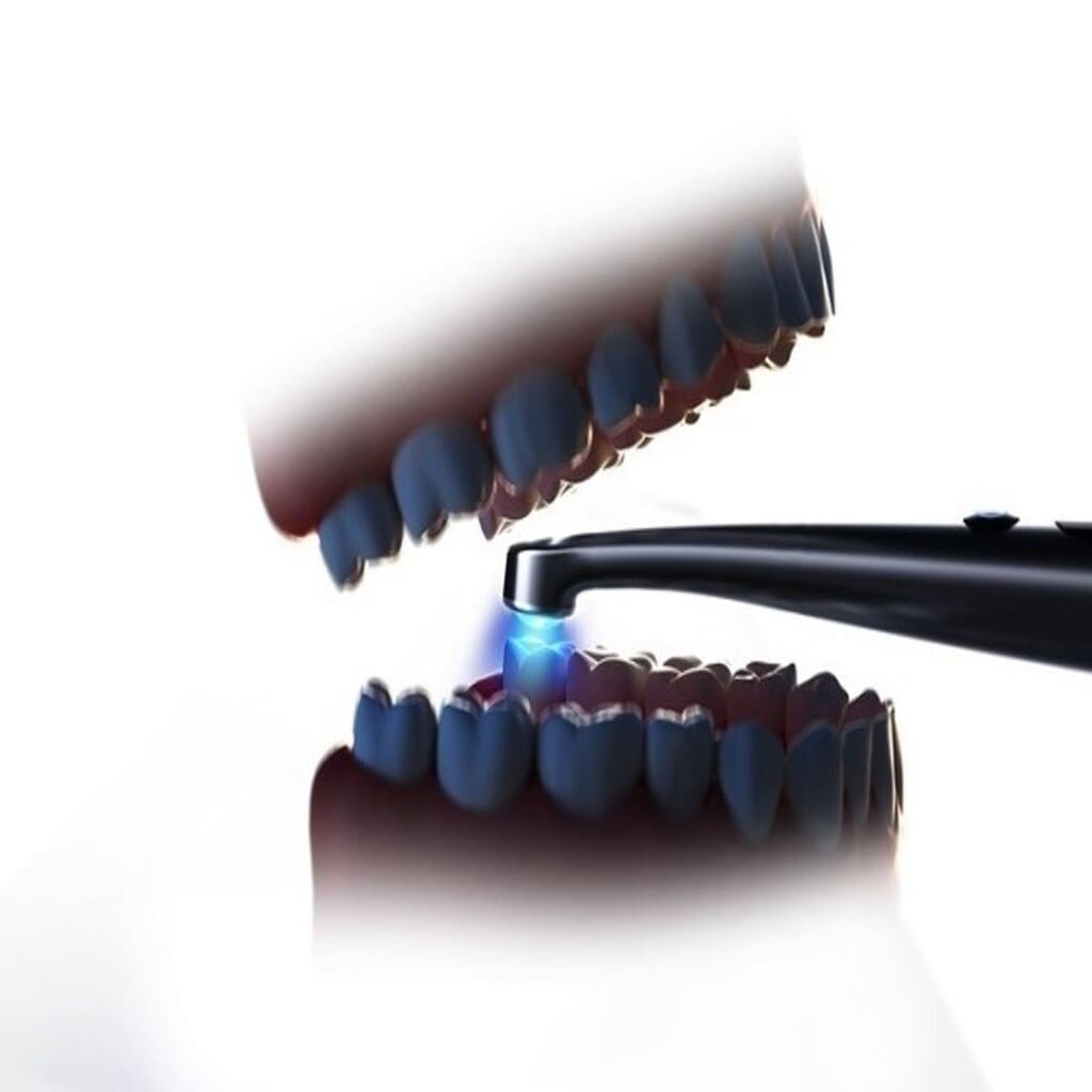  لایت کیور  Woodpecker _  O_Star Pro
at work