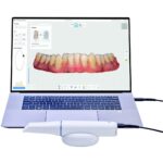 نحوه اتصال اسکنر داخل دهانی medit i900