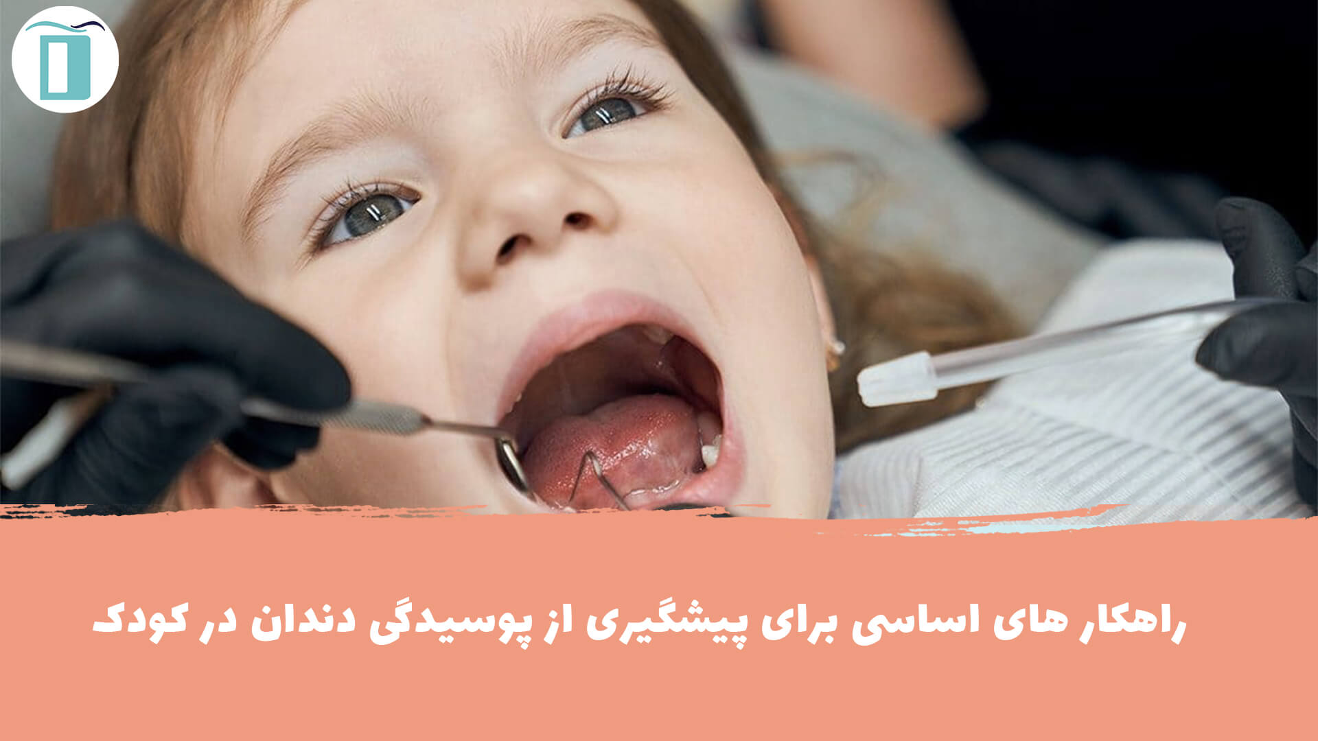راهکار های پیشگری و درمان پوسیدگی زودرس دندان در کودکان
