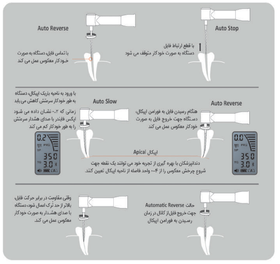 اپکس روتاری و اندوموتور وایرلس Bomedent - iRoot Pro