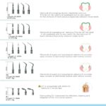 نوک (تیپ) اندو سرقلم جرمگیری E1 برند Baolai - تصویر 4