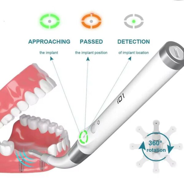 عملکرد ایمپلنت لوکیتور هاربوردنت - implant locator -detector- HARBOR DENT