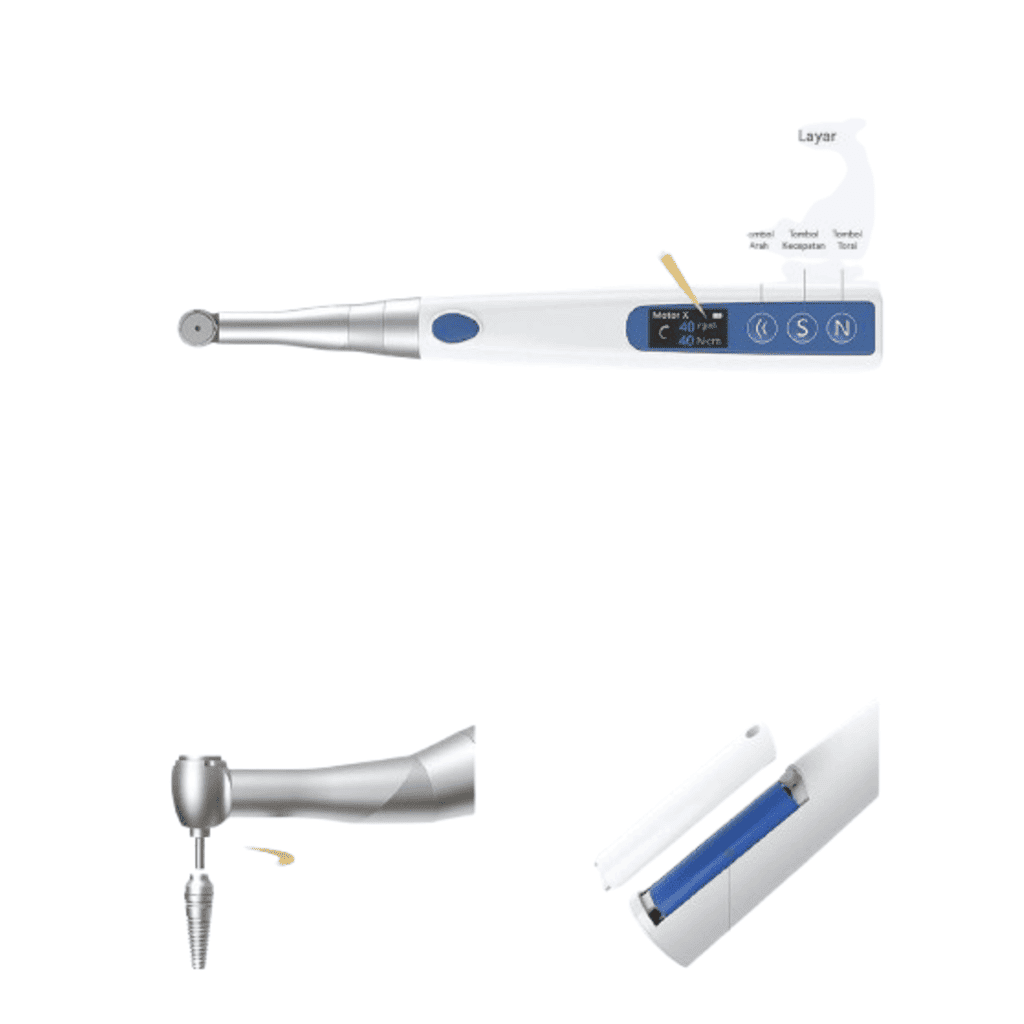 ترکمتر دیجیتال ایمپلنت-کاشت ایمپلنت-وستکد westcod smart implant torque wrench