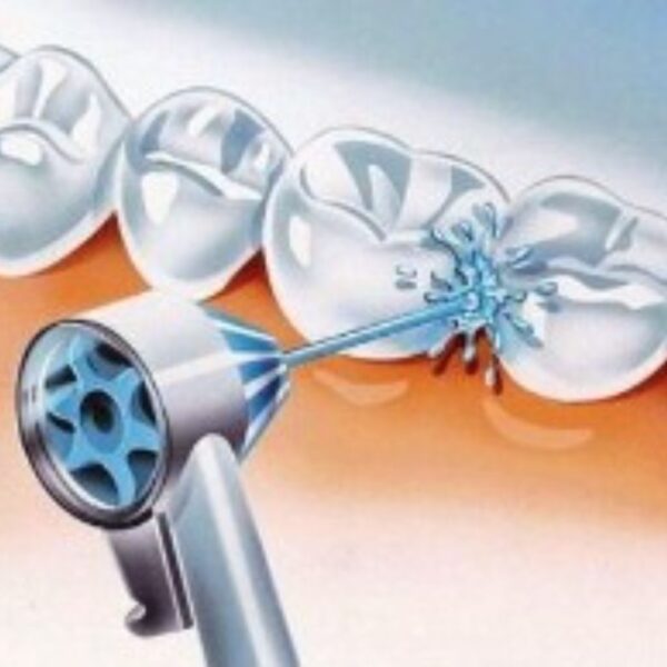 سری مسواک برقی اورال بی oral-b md20 oxyjet